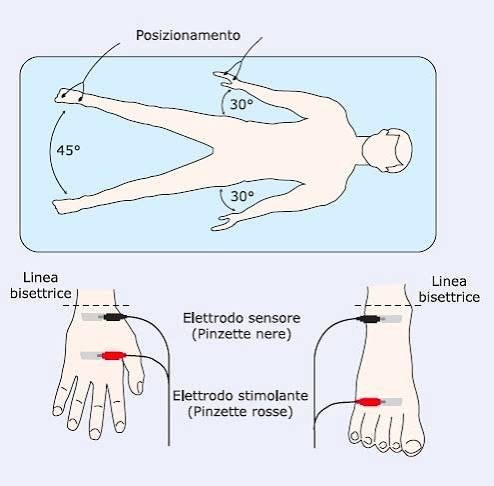 Schema del corretto posizionamento del corpo e degli elettrodi per una misurazione di bioimpedenziometria