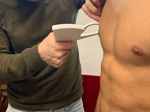 Misurazione di una plica cutanea con un plicometro